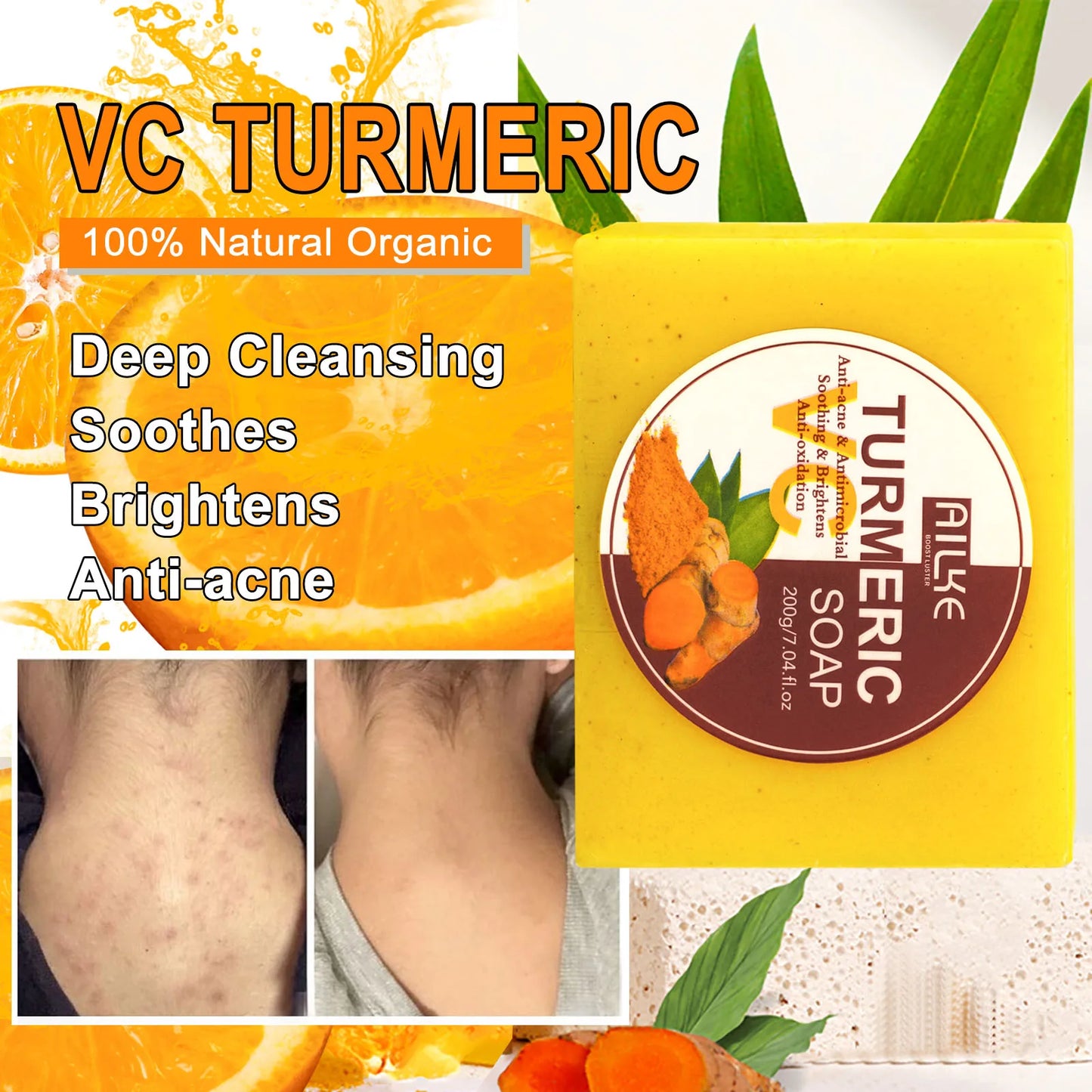 AILKE Organic Turmeric Skin Care Set For Brightening Acne Removal