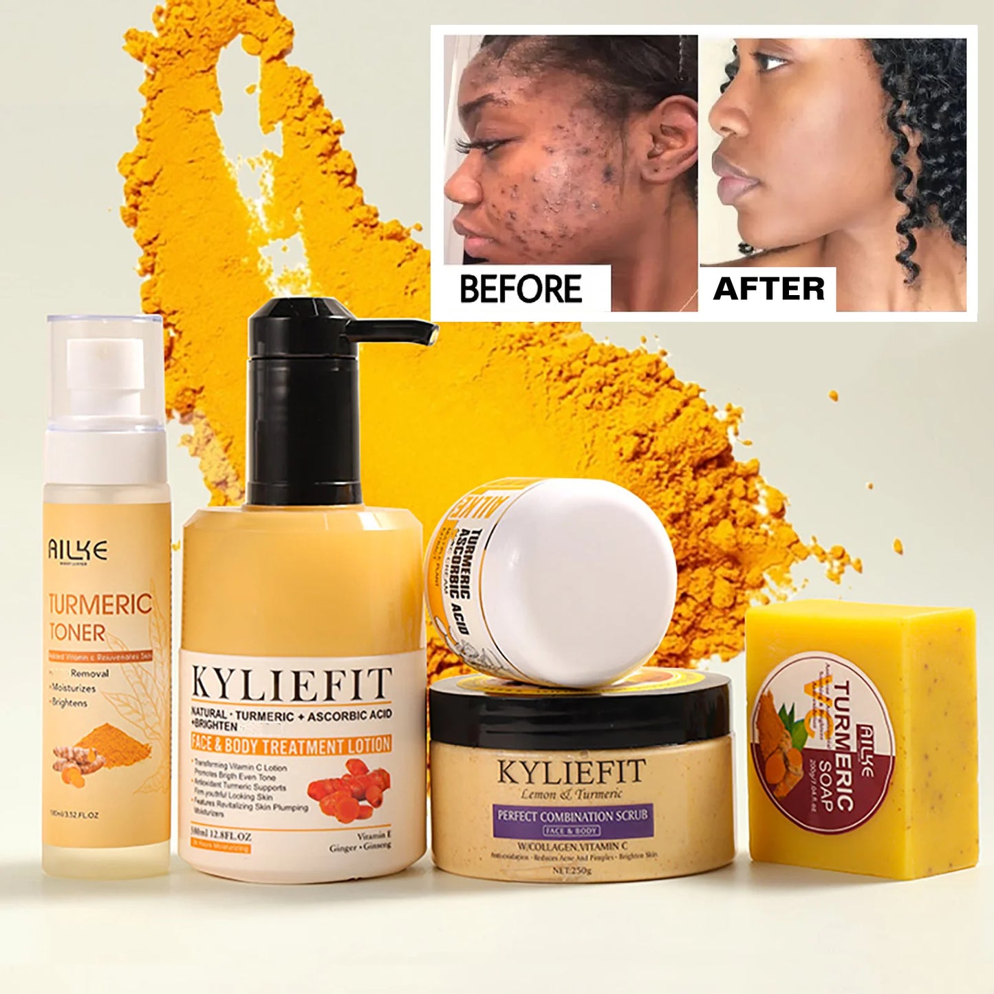 AILKE Organic Turmeric Skin Care Set For Brightening Acne Removal
